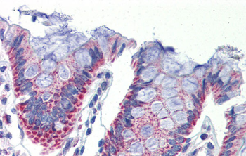 IMPDH1 Rabbit Polyclonal Antibody