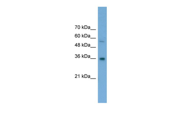 GALE Rabbit Polyclonal Antibody