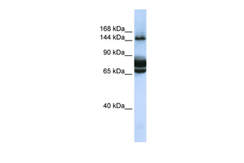 FAM83B Rabbit Polyclonal Antibody