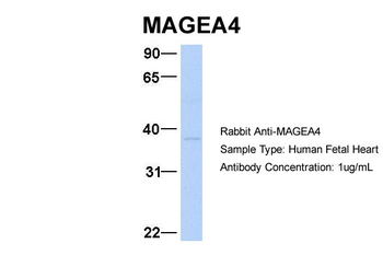 MAGEA4 Rabbit Polyclonal Antibody