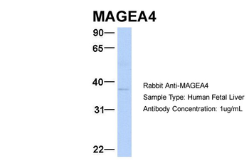 MAGEA4 Rabbit Polyclonal Antibody