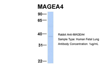 MAGEA4 Rabbit Polyclonal Antibody