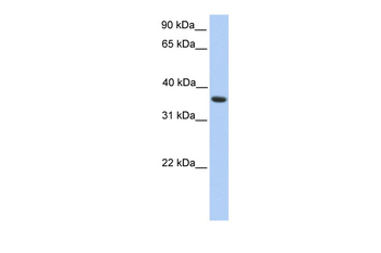 MAGEA4 Rabbit Polyclonal Antibody