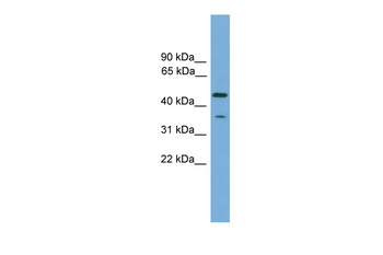 C6orf154 Rabbit Polyclonal Antibody