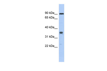 C6orf154 Rabbit Polyclonal Antibody