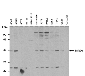 AMD1 Rabbit Polyclonal Antibody