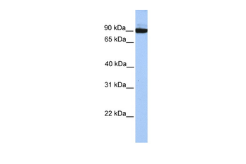 PCDH17 Rabbit Polyclonal Antibody