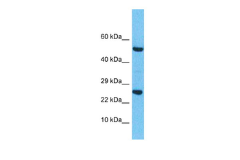 RRAS2 Rabbit Polyclonal Antibody