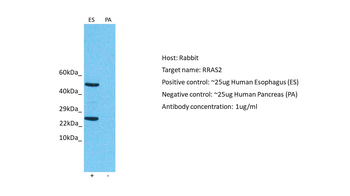 RRAS2 Rabbit Polyclonal Antibody