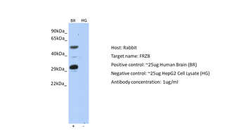 FRZB Rabbit Polyclonal Antibody