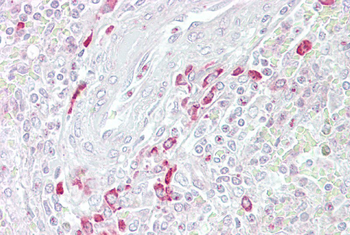 FRZB Rabbit Polyclonal Antibody