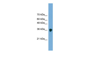 FRZB Rabbit Polyclonal Antibody