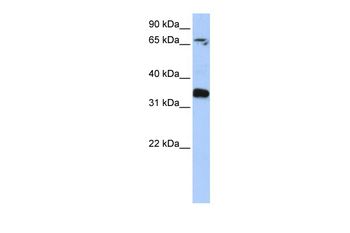 GLE1 Rabbit Polyclonal Antibody