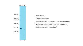 ARF6 Rabbit Polyclonal Antibody
