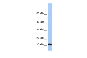 FAU Rabbit Polyclonal Antibody