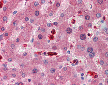 GCLM Rabbit Polyclonal Antibody