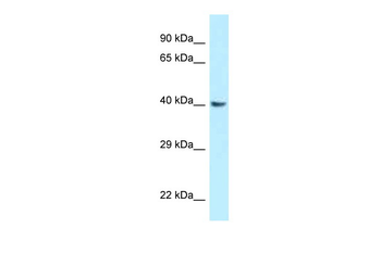Gnaq Rabbit Polyclonal Antibody