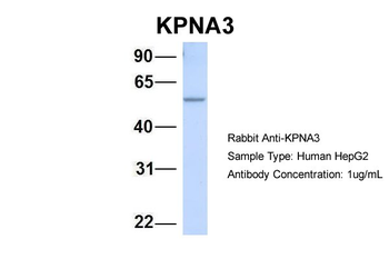 KPNA3 Rabbit Polyclonal Antibody