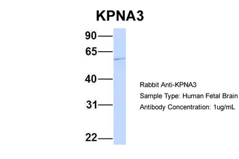 KPNA3 Rabbit Polyclonal Antibody