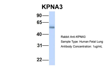 KPNA3 Rabbit Polyclonal Antibody