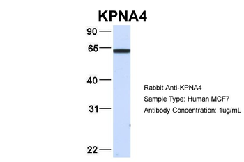 KPNA4 Rabbit Polyclonal Antibody
