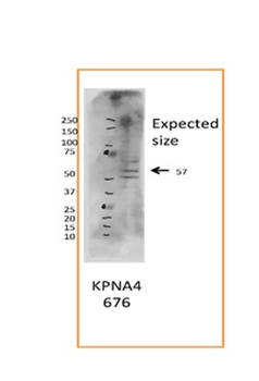 KPNA4 Rabbit Polyclonal Antibody