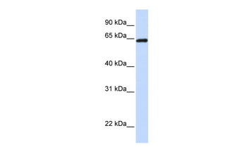LCP1 Rabbit Polyclonal Antibody