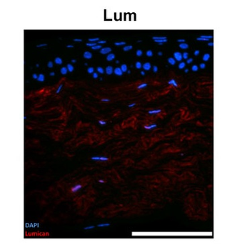 Lum Rabbit Polyclonal Antibody