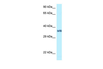 Lum Rabbit Polyclonal Antibody
