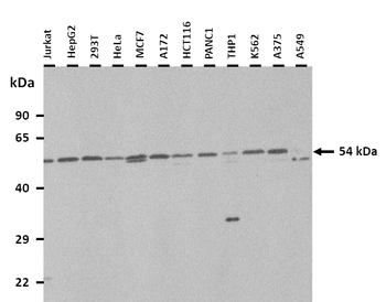 FDXR Rabbit Polyclonal Antibody