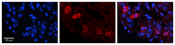 GRK5 Rabbit Polyclonal Antibody