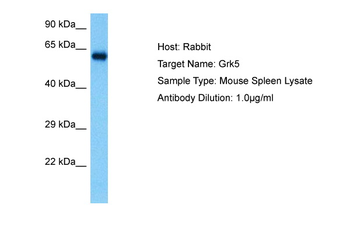 GRK5 Rabbit Polyclonal Antibody