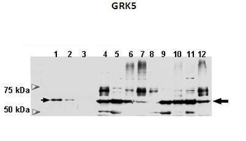 GRK5 Rabbit Polyclonal Antibody