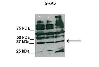 GRK5 Rabbit Polyclonal Antibody