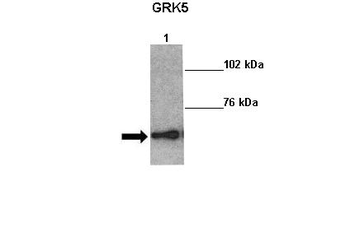 GRK5 Rabbit Polyclonal Antibody