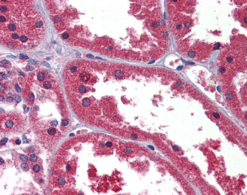 HINT1 Rabbit Polyclonal Antibody