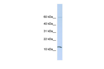 HINT1 Rabbit Polyclonal Antibody