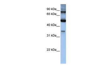 INPP5B Rabbit Polyclonal Antibody