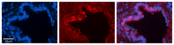 LDHA Rabbit Polyclonal Antibody