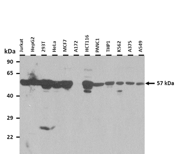 PHGDH Rabbit Polyclonal Antibody
