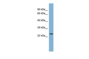 GLO1 Rabbit Polyclonal Antibody