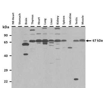 Lmod1 Rabbit Polyclonal Antibody