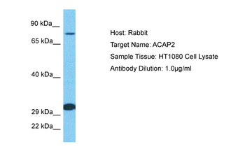 ACAP2 Rabbit Polyclonal Antibody