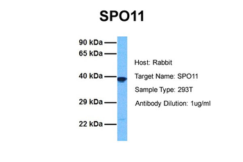 SPO11 Rabbit Polyclonal Antibody