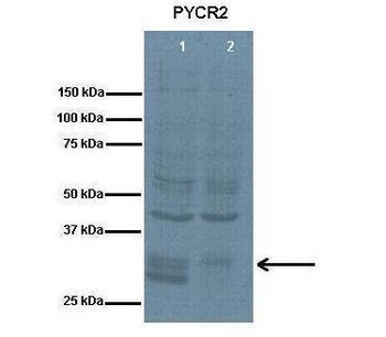 PYCR2 Rabbit Polyclonal Antibody