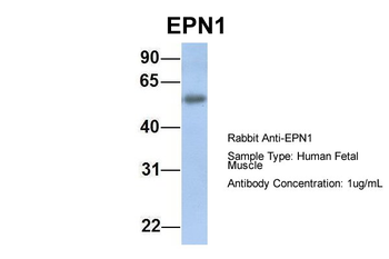 EPN1 Rabbit Polyclonal Antibody