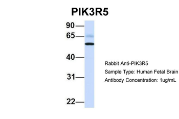 PIK3R5 Rabbit Polyclonal Antibody