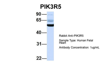 PIK3R5 Rabbit Polyclonal Antibody