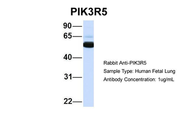 PIK3R5 Rabbit Polyclonal Antibody