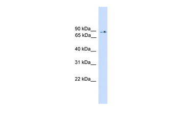PIK3R5 Rabbit Polyclonal Antibody